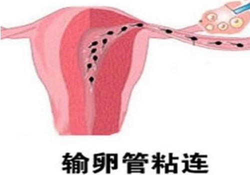 北京试管助孕公司：新西兰安满孕妇奶粉怎么样,搞清楚各方面才敢放心喝