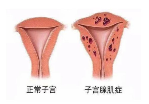 高龄女性的困惑，怀孕后反复胎停育怎么办？