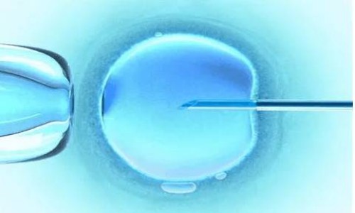 取卵术后腹痛、腹胀，该如何应对？