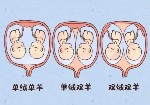 北京助孕中心：多囊卵巢可以做试管婴儿吗,多囊卵巢做试管婴儿成功率高吗