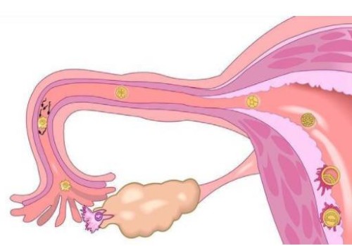 北京试管助孕公司：母乳性黄疸的早期症状！看完这篇你就了解了